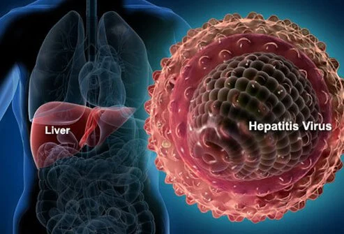 Hepatitis C Prevalent Among Adults Aged 15 To 64 Years In Nigeria – WHO |  Science Nigeria