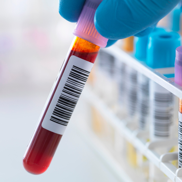 Laboratory blood