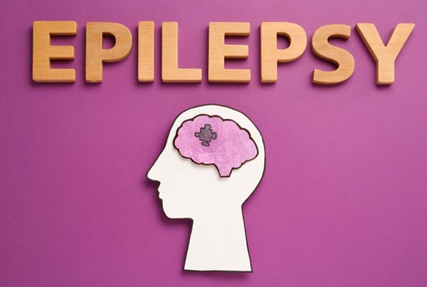 Epilepsy